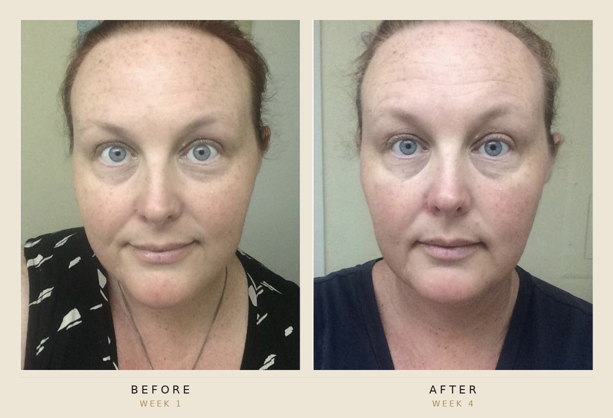 A side-by-side before and after facial skin comparison of a woman, labeled 'BEFORE WEEK 1' on the left and 'AFTER WEEK 4' on the right, with a beige border around the photos.