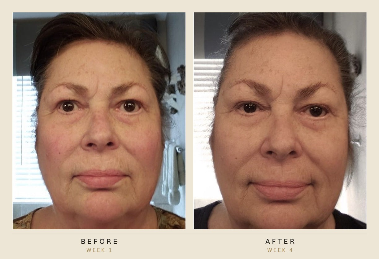A side-by-side before and after facial comparison of a woman, labeled 'BEFORE WEEK 1' on the left and 'AFTER WEEK 4' on the right, with a light beige border around the collage.