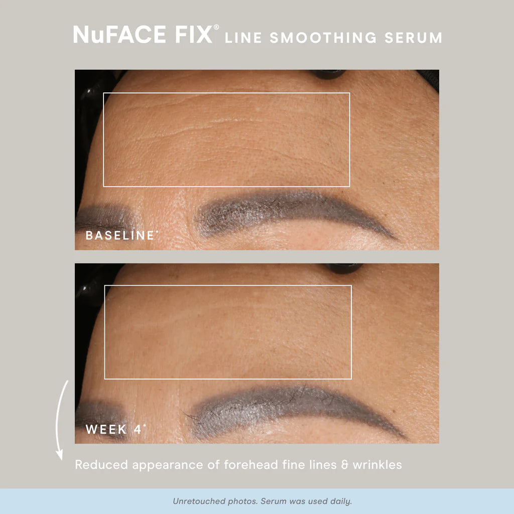 NuFACE FIX® Starter Kit - The Skincare Boutique
