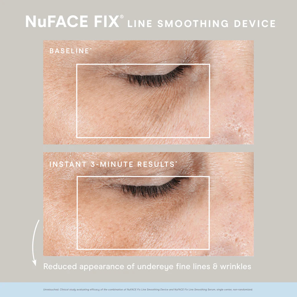 NuFACE FIX® Starter Kit - The Skincare Boutique
