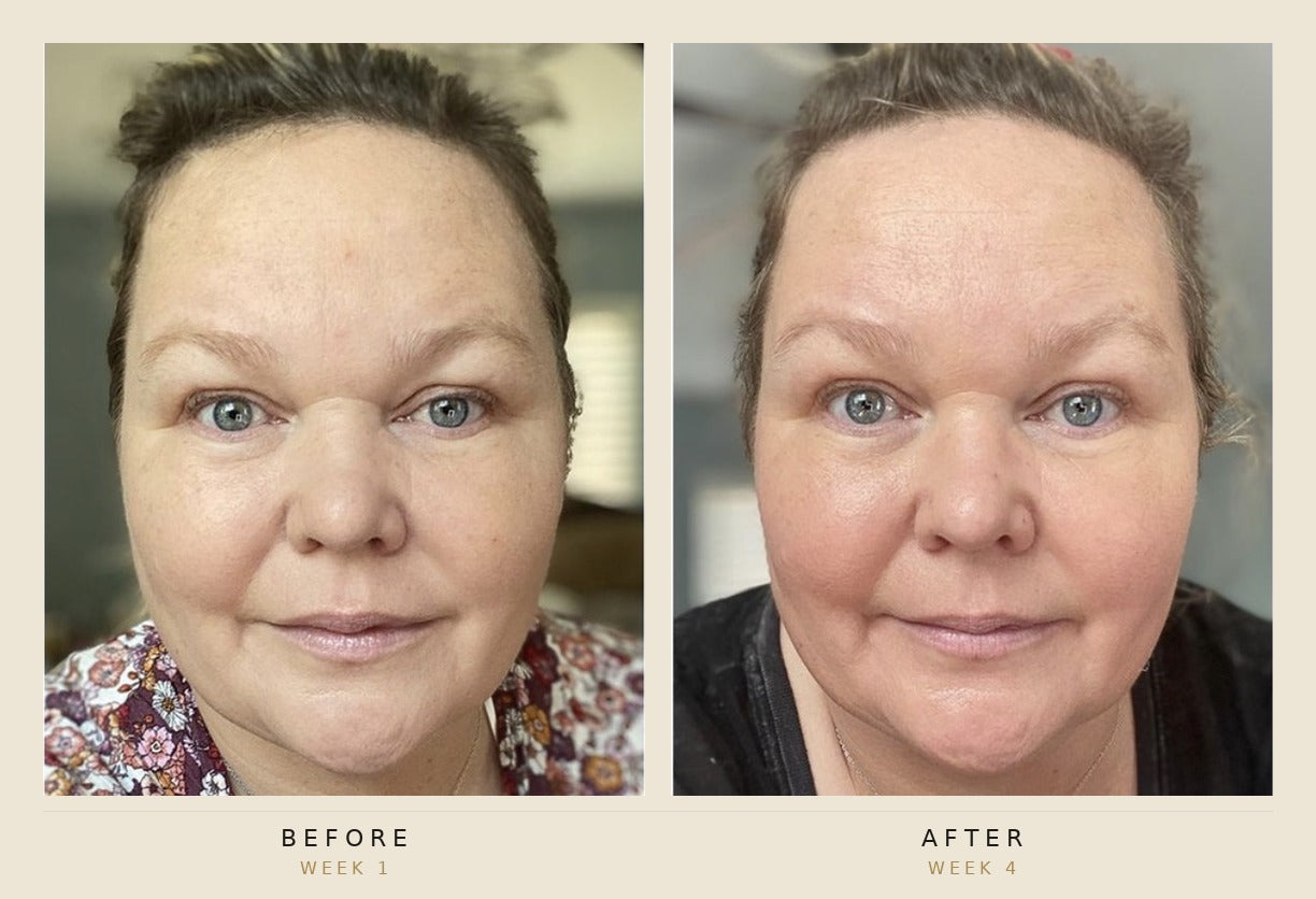 A side-by-side before and after facial skin comparison of a woman, labeled 'BEFORE WEEK 1' on the left and 'AFTER WEEK 4' on the right, with a beige border around the photos.