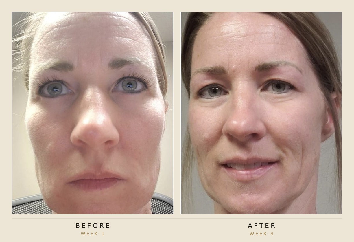 A side-by-side before and after facial comparison of a woman's face, labeled 'BEFORE WEEK 1' on the left and 'AFTER WEEK 4' on the right, with a beige border around the collage.