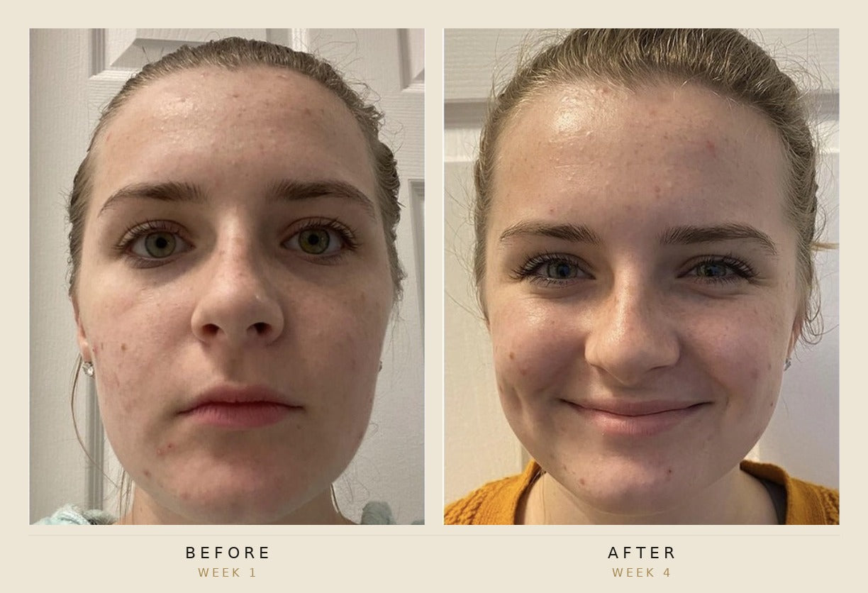 A side-by-side before and after facial skin comparison of a woman, labeled 'BEFORE WEEK 1' on the left and 'AFTER WEEK 4' on the right, with a beige border around the photos.