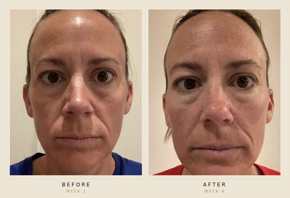 A side-by-side before and after facial comparison of a woman, labeled 'BEFORE WEEK 1' on the left and 'AFTER WEEK 4' on the right, showing skin improvement over time against a plain indoor background.